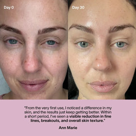 Side-by-side photos of a woman's face labeled Day 0 and Day 30 show reduced redness and smoother skin after using the Solawave 2x Wrinkle Retreat LED Face Mask, with a testimonial praising fewer wrinkles, breakouts, and better skin texture.